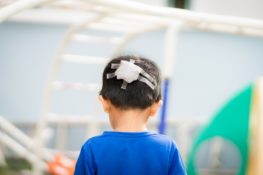 child with a bandage in the head